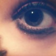 My eye